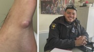 North Carolina police officer beats rare bone cancer, returns to work after months