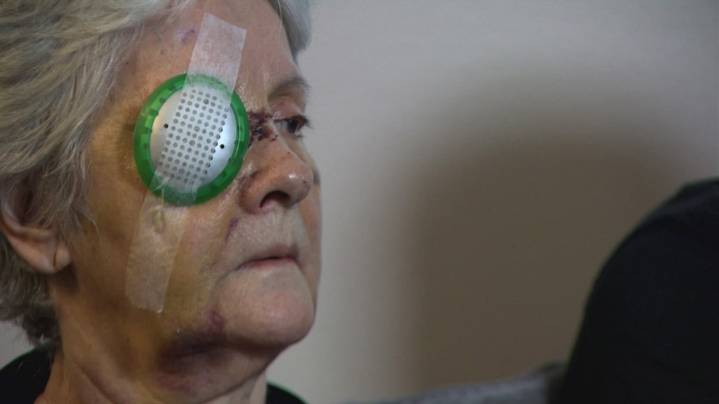 'Nobody deserves this': Seattle woman speaks out after brutal, unprovoked attack