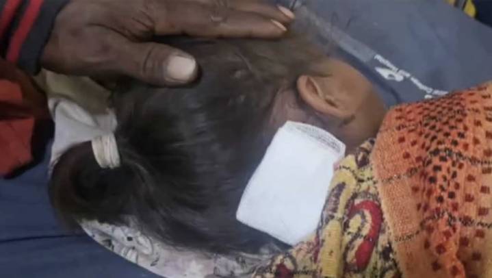 Six-Year-Old Girl Attacked by Stray Dogs in Bavla