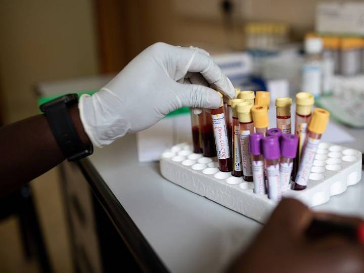 New HIV prevention guidelines say doctors should not 'gatekeep' meds