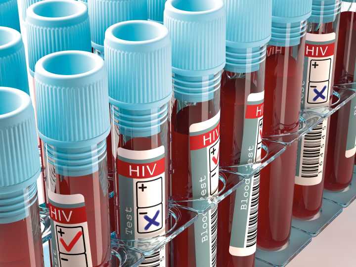 Five-Minute HIV Test Differentiates Active Infection from Vaccinations