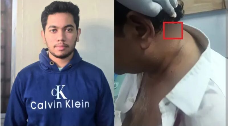 Basavanagudi Police Arrest Law Student After Entrepreneur Shot During Practice