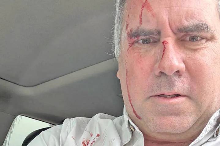 Intento de ataque contra candidato peruano reaviva debate sobre seguridad rumbo a elecciones 2026