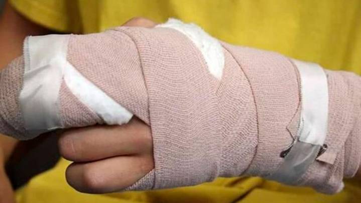 Nariño registra 12 casos de lesionados por pólvora en la temporada de vigilancia intensificada