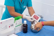 ES GRATIS: Conoce dónde hacerte la prueba rápida de VIH en EsSalud este 1 de diciembre