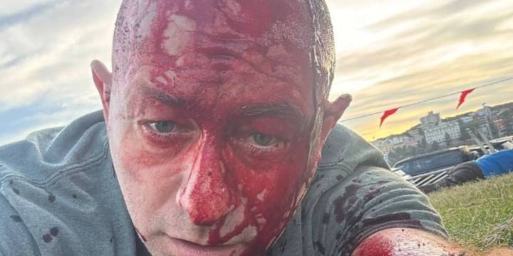 Sobrevivió al ataque terrorista de Hamas del 7 de octubre y años después resultó herido en el atentado en Australia: “Fue una masacre”