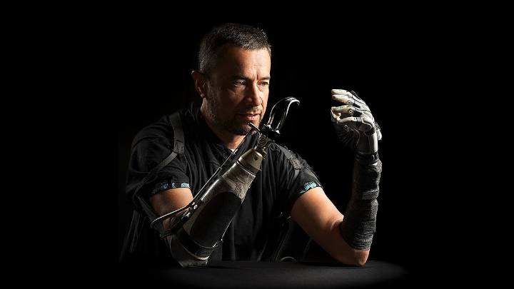 Improved Bionic Hand Has A Mind Of Its Own, Researchers Say