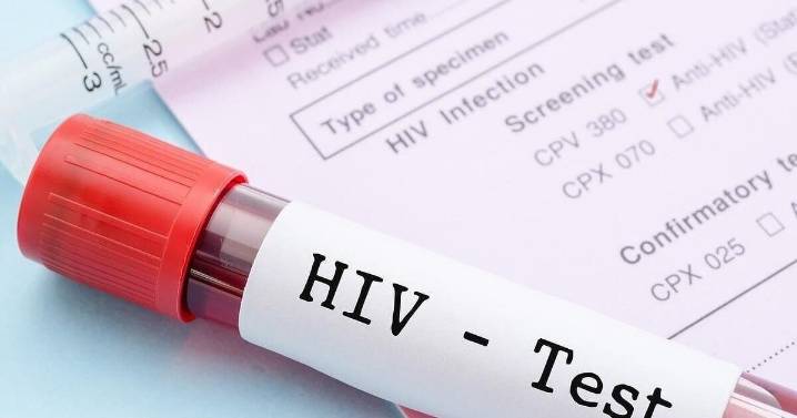 Small Trial Shows Patients Controlled HIV Without Daily Meds For Months