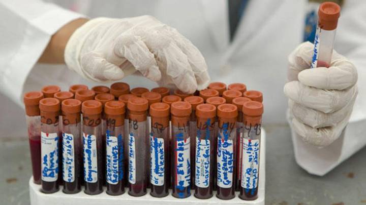 Málaga registró 145 nuevos casos de VIH en 2024, la mayor cifra de Andalucía