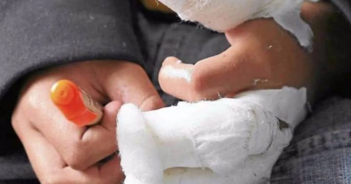 Alarmante: los adultos siguen siendo los principales lesionados por pólvora; cuatro heridos en Armenia