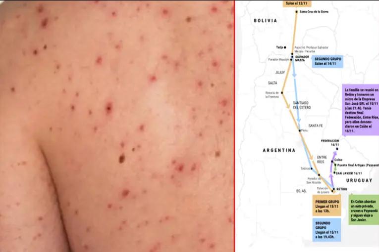 La familia que cruzó medio país con sarampión tuvo al menos 98 contactos estrechos e investigan otros 54