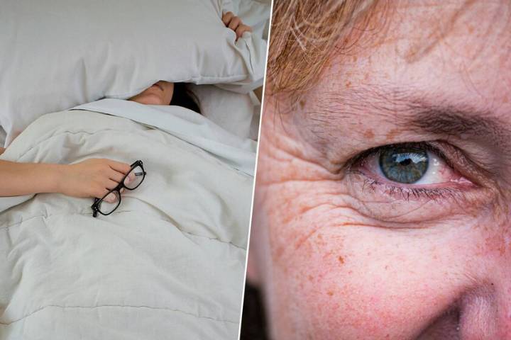 Hay gente que cree que dormir de lado o boca abajo crea "arrugas del sueño" en la cara. Es exactamente al contrario