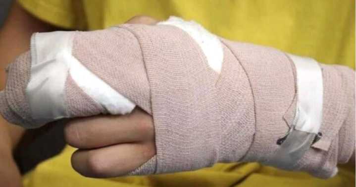 Menor perdió varios dedos y otra persona resultó quemada durante la Noche de Velitas