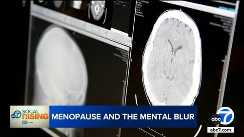 New UCLA study finds hormone therapy could protect women's brains as they age, during menopause
