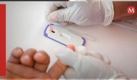 ¿Dónde hacerte pruebas de VIH GRATIS en CdMx? Aquí las ubicaciones donde hay y en qué horarios