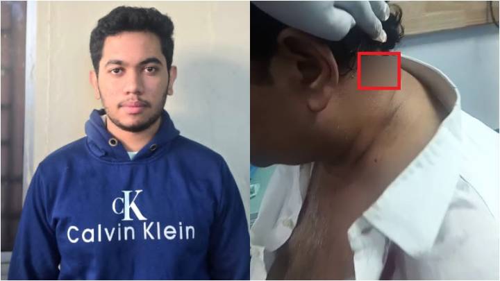 Law student arrested for shooting at businessman with air gun, misfire suspected