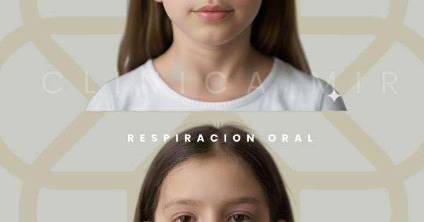La respiración oral: un hábito silencioso que afecta al desarrollo facial