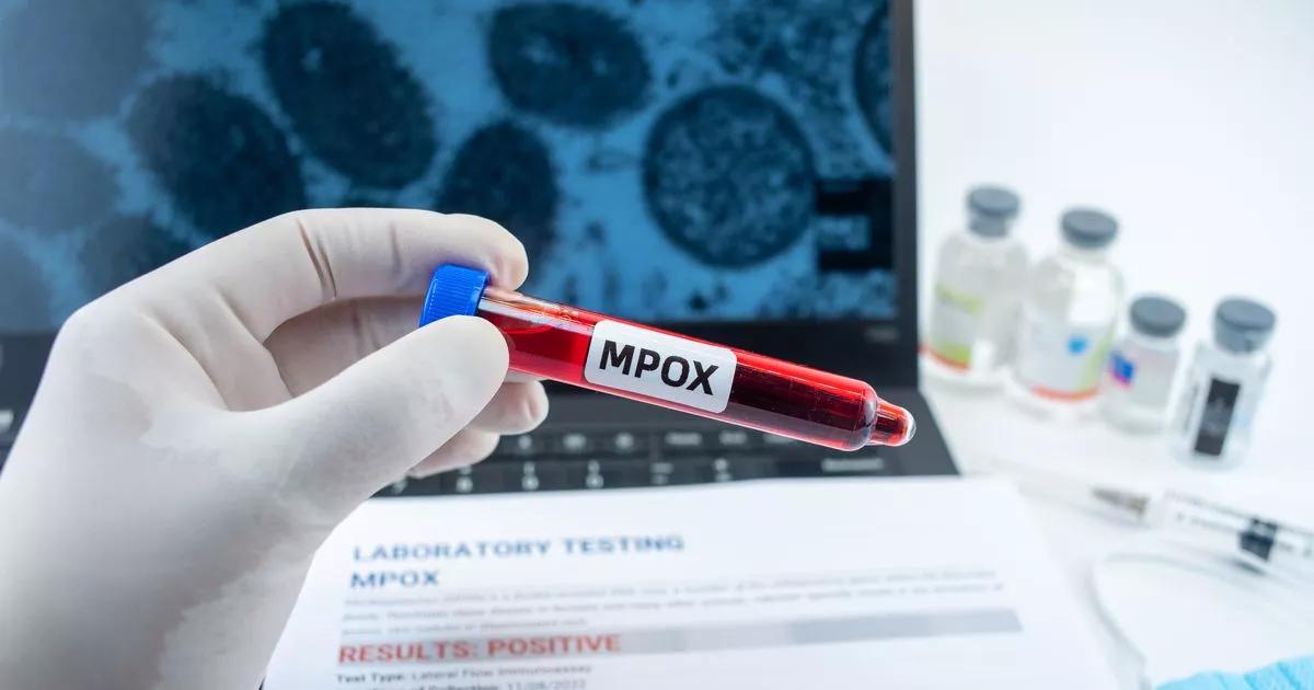 Mpox strain recently found in England is 'precisely what experts in the field feared would happen'