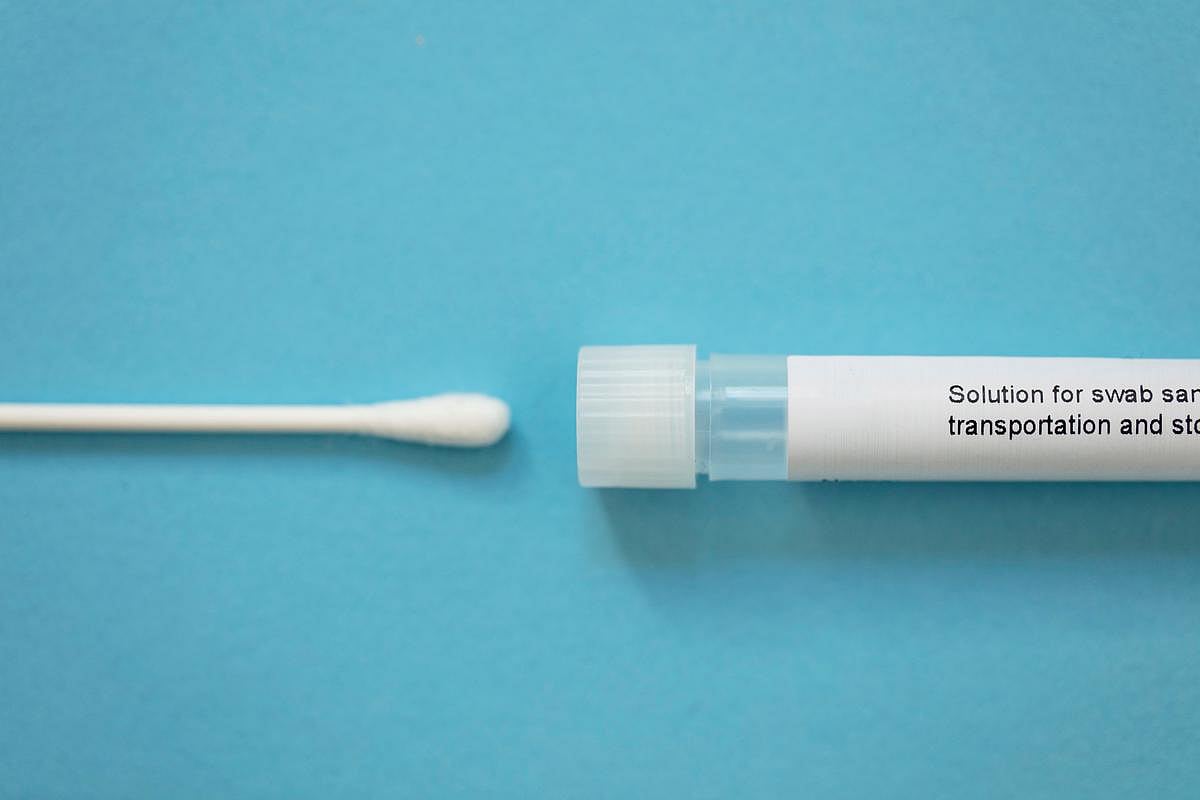 Guidelines Expanded for Cervical Cancer Screening to Include Self