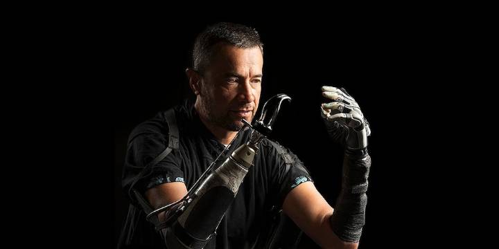 Mejoran mano biónica con mente propia, según investigadores.