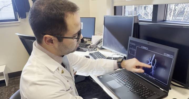 Montana doctor says early detection key to preventing lung