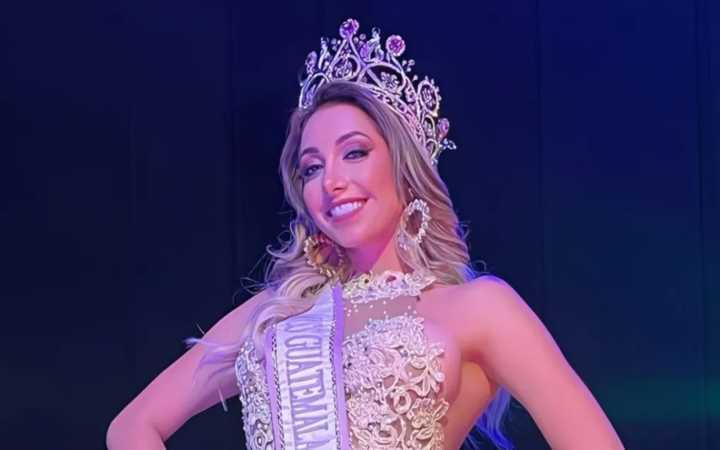 Murió la presentadora y exreina de belleza Raquel Escalante a los 28 años