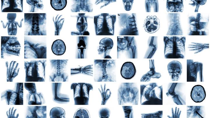 Cognita CEO on next steps for vision language models in radiology