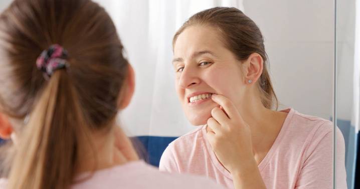 Recessed maxilla is TikTok's newest teeth fixation but dentists say viral fix won't work