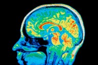 Supposedly distinct psychiatric conditions may have same root causes