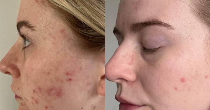 Unique dermatologist-approved skincare serum is 'what I've been looking for for years'