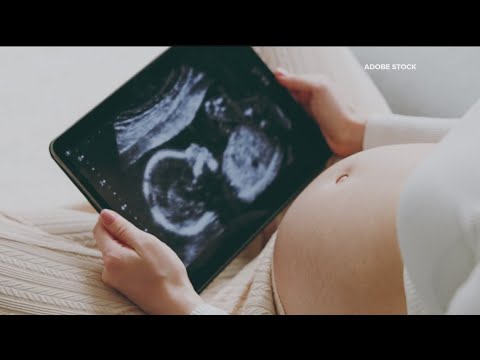 Groundbreaking effort between Georgia Tech, UGA and Emory reimagining health wearables