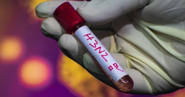 Doctors warn of one unusual sign of deadly H3N2 superflu