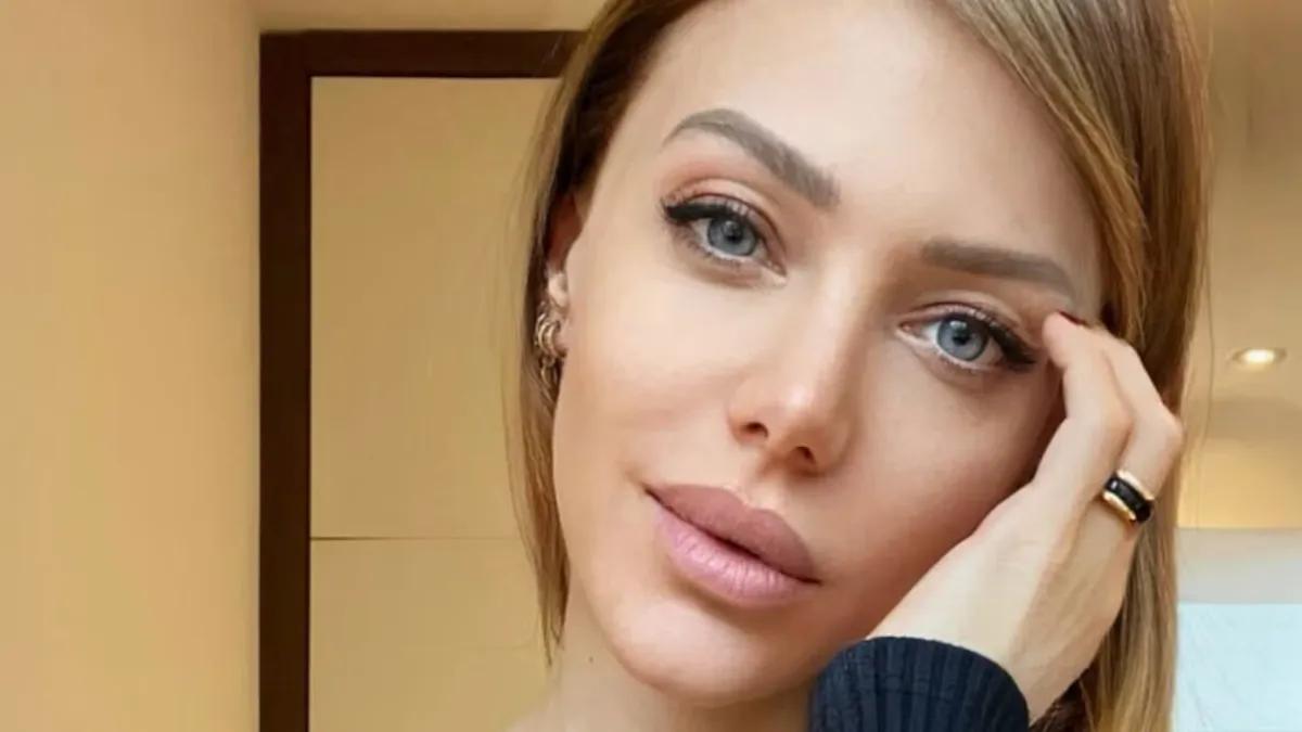 Preocupación por el impactante tratamiento estético al que se sometió Evangelina Anderson