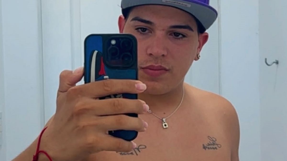 Las impactantes fotos de Thiago Medina de las cicatrices en su cuerpo tras la larga y riesgosa operación