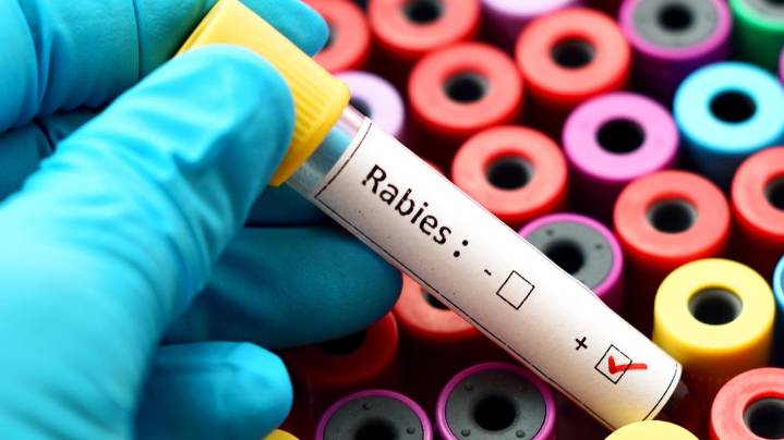 New details from CDC show what led to fatal Toledo human rabies case