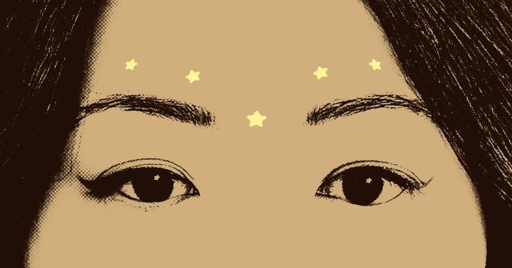 Baby Botox Softened My Fine Lines Without Freezing My Face