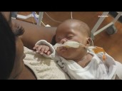 Baby of Georgia woman who carried baby while brain dead still in NICU