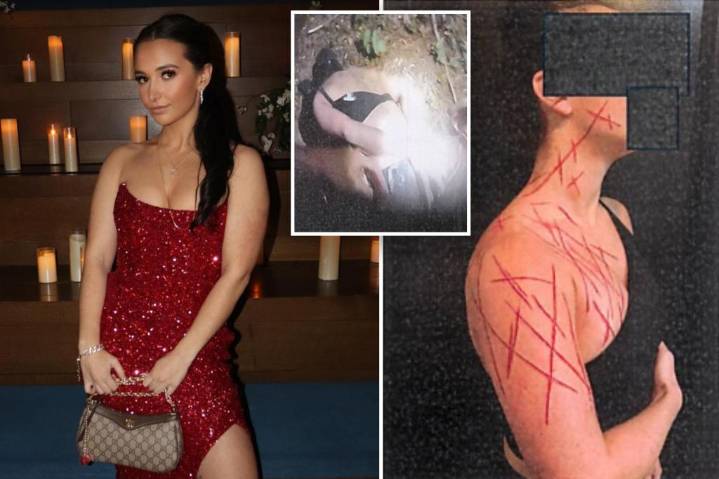 Ex-NJ GOP aide ordered to get mental help after allegedly brutalizing herself in fake anti