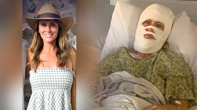 'Horrific': Georgia woman left with third-degree burns after chemical attack by random man