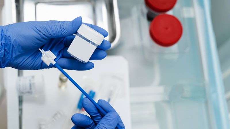 Cervical cancer screening just got easier. A doctor explains why this change matters