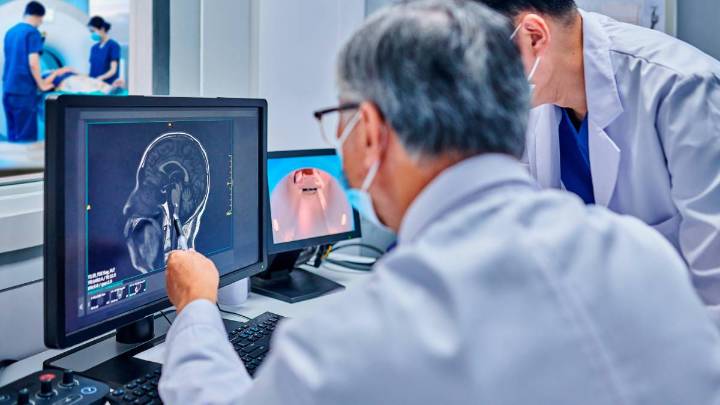 Crean herramienta que predice el riesgo de Alzheimer años antes de los primeros síntomas