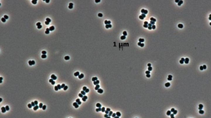 This Microbe 'Plays Dead' in NASA Clean Rooms, and We May Have Sent It to Mars