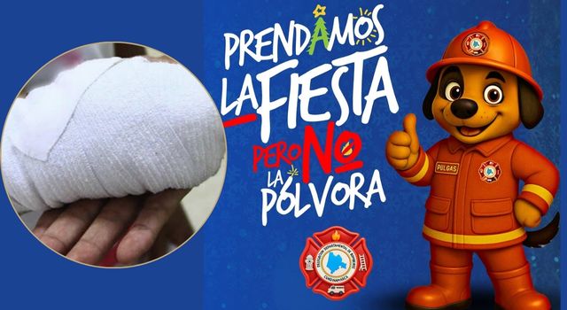 Primer quemado con pólvora en Cundinamarca, es menor de edad