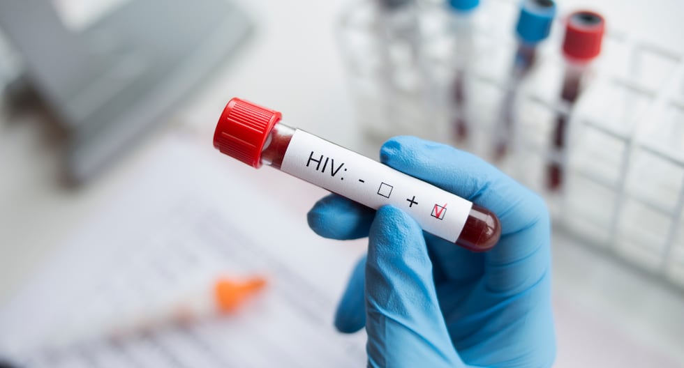 Vivir con VIH en Perú: avances médicos y nuevas estrategias para mejorar la calidad de vida