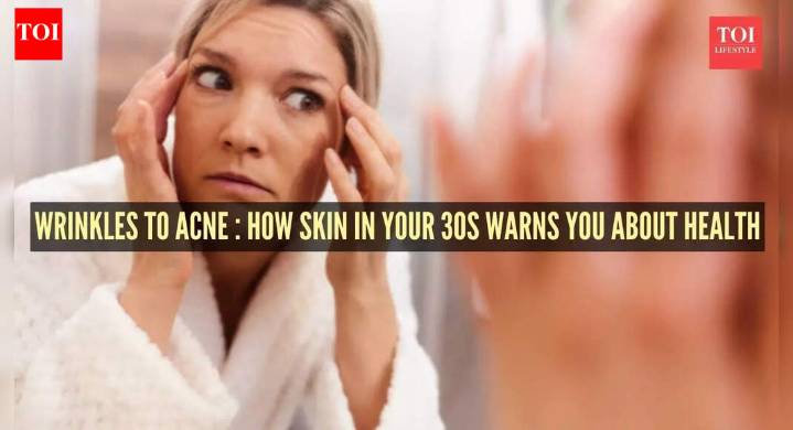 Skin in your 30s as a health report card: Pigmentation, acne, hair fall and what they hint at inside