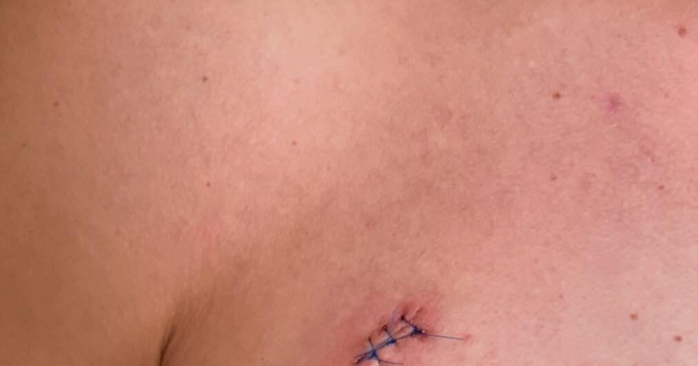 Guelph man stabbed in chest trying to stop break