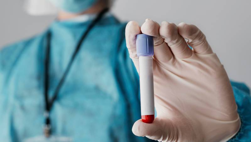 Actividades por el Día Mundial de Respuesta al VIH/Sida