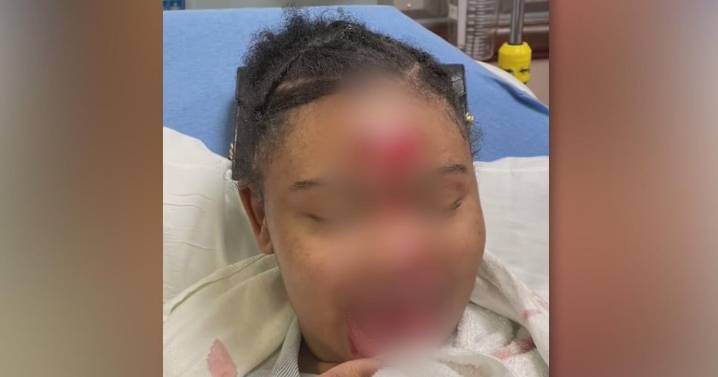 Family questions DeSoto ISD after disabled teen hurt at school