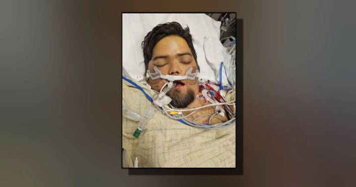 Mother shares son's near-death battle with fungal infection as state investigates outbreak