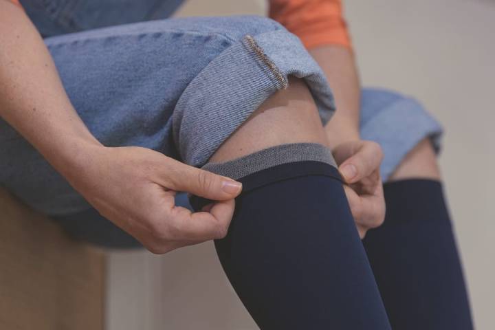 Cuidado con las piernas cansadas, podría tratarse de insuficiencia venosa crónica